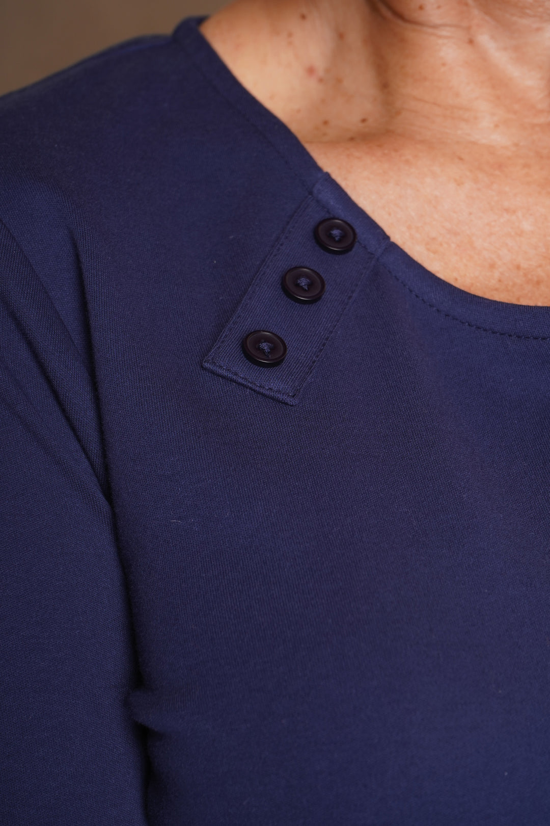 Button Detail Top